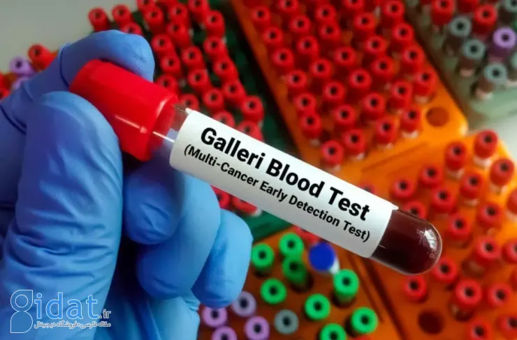 آزمایش خون Galleri می‌تواند بیش از ۵۰ نوع سرطان را در مراحل اولیه تشخیص دهد