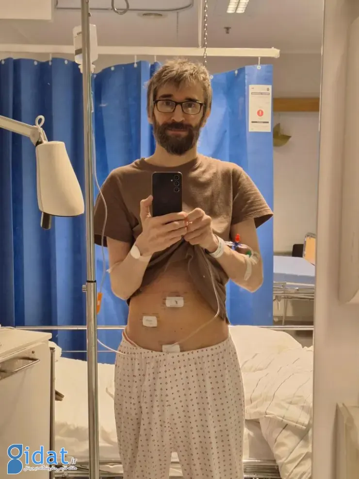 تشخیص آپاندیس توسط Grok