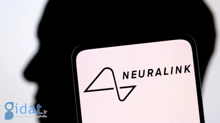 Neuralink فرآیند اولین آزمایش انسانی تراشه مغز خود را آغاز می کند