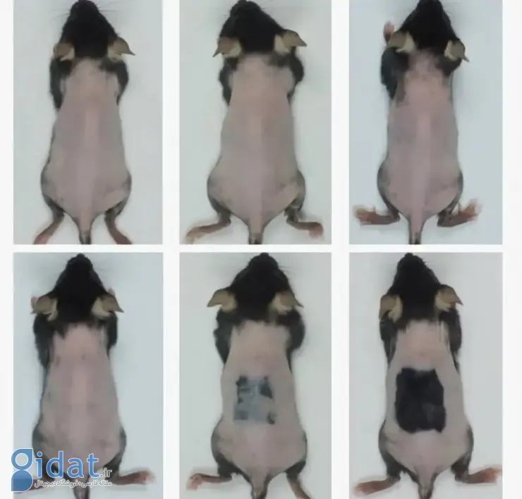 درمان ریزش مو با سرم جدید