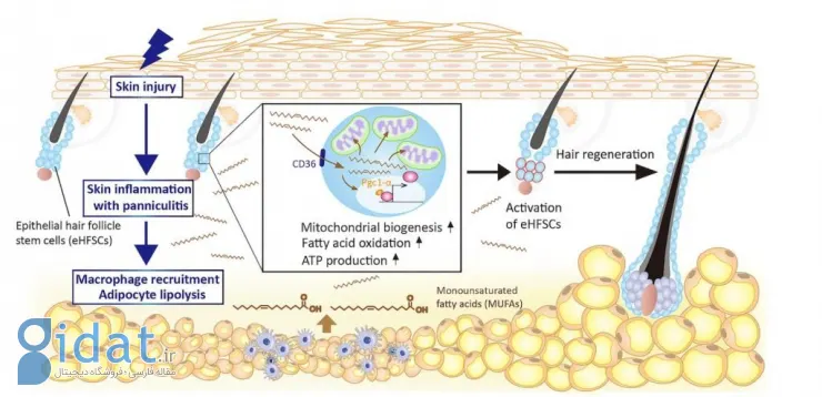 درمان ریزش مو با سرم جدید