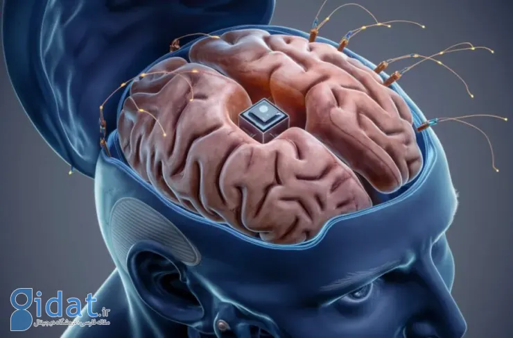 Neuralink تاییدیه FDA را برای دومین جراحی کاشت تراشه در مغز انسان دریافت کرد