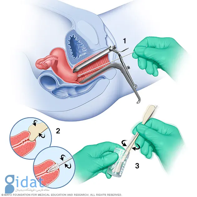 هرآنچه باید درباره اچ‌پی‌وی (HPV) بدانید