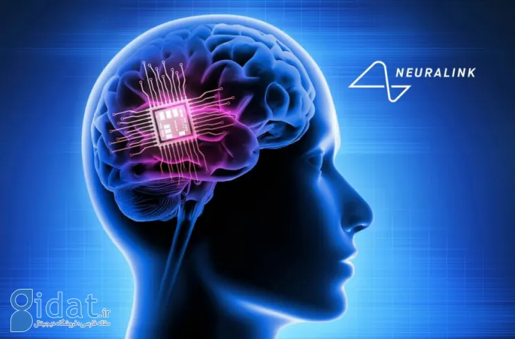 اولین بیمار Neuralink توضیح داد: اگر تراشه مغز هک شود چه اتفاقی می افتد؟