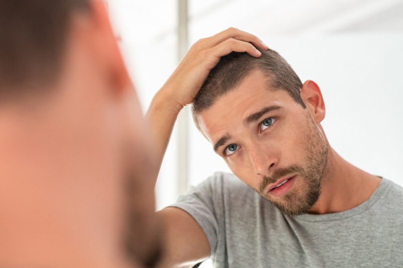 نتیجه کاشت مو به چه عواملی بستگی دارد؟