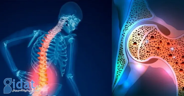 این بیماری از دهه چهارم زندگی شروع می‌شود