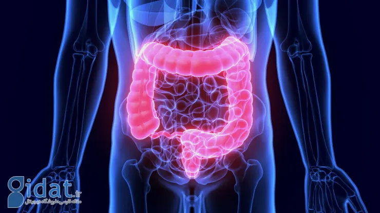 چند نکته درباره مبتلایان به روده خجالتی!