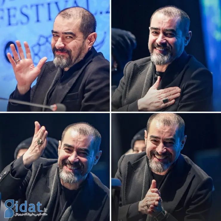 عکسی از صورت شکسته شهاب حسینی که جلب توجه کرد