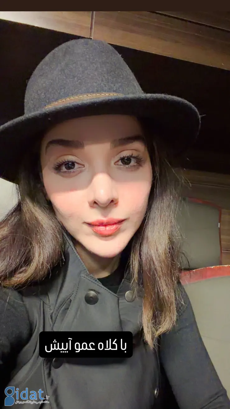 المیرا دهقانی از سبک فرهاد آئیش کپی کرد!