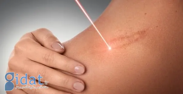 نقش سلول های بنیادی در زخم ها