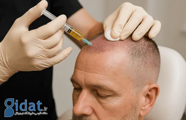 چرا پی آر پی مو روشی مؤثر است؟