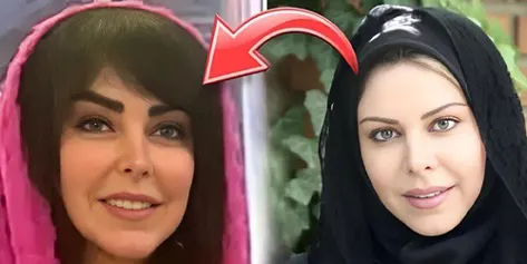 تغییر چهره عجیب 7 بازیگر زن ایرانی که هوادارانشان را سورپرایز کرد