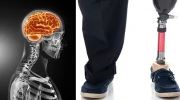 داستان مردی که از پزشکان خواست دو انگشتش را قطع کنند