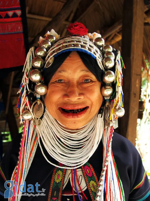 با ۱۰ مورد از عجیب ترین ترندهای زیبایی تاریخ آشنا شوید