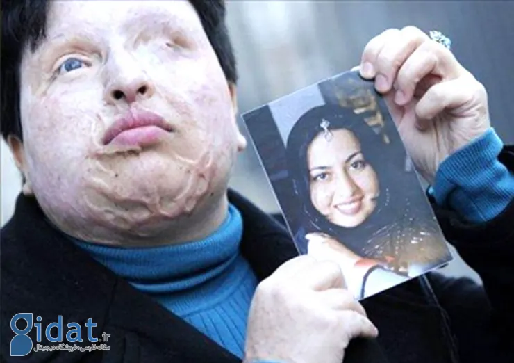 حضور امینه بهرامی در دادسرای جنایی تهران