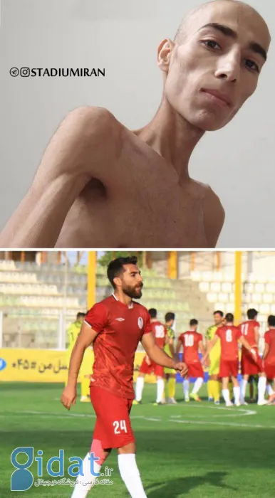 عکسی باورنکردنی از فوتبالیست ایرانی پس از سرطان