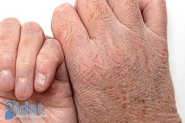 راهکارهای ساده برای جلوگیری از خشکی بدن در سرما