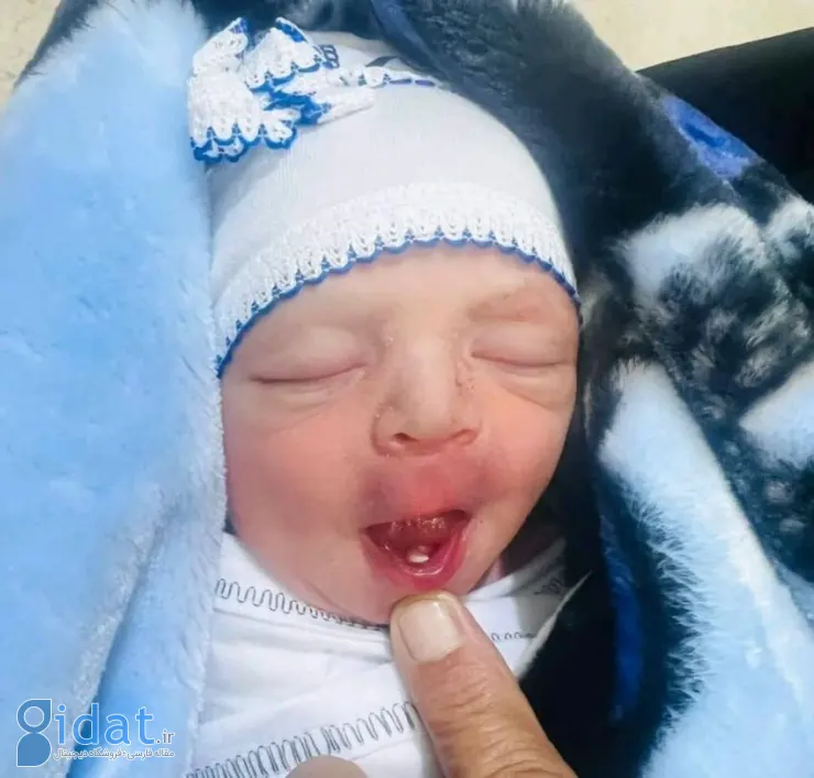 این نوزاد با چیزی غیرمعمول به دنیا آمد!