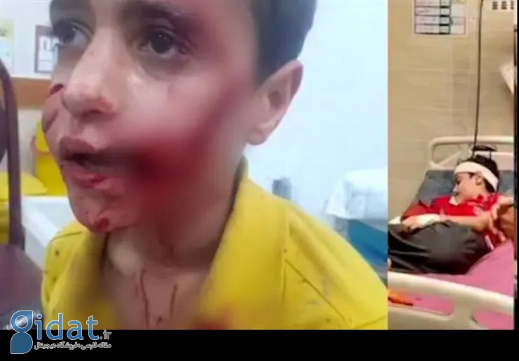 مرگ کودک ۱۰ ساله بر اثر حمله سگ‌های ولگرد