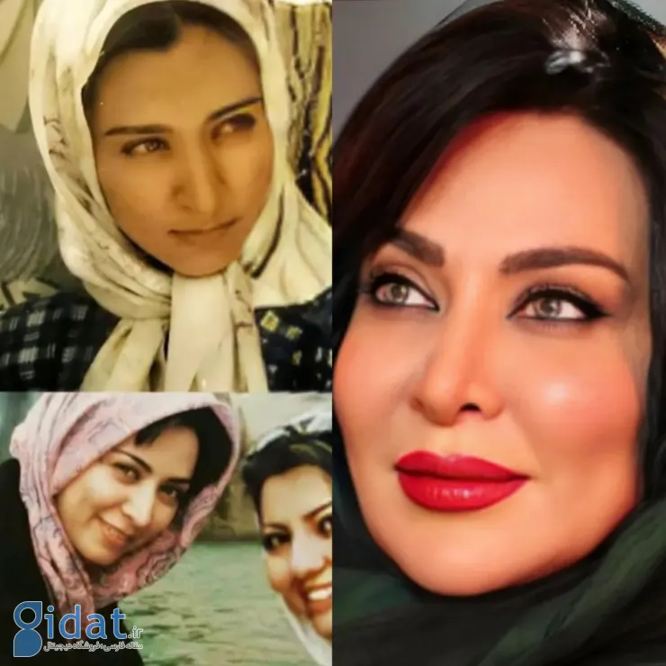 تصاویر قابل توجه فقیهه سلطانی قبل از عمل زیبایی