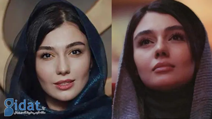 ونوس کانلی: به خاطر زیبایی صورتم از یک پروژه رد شدم