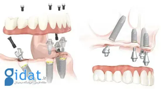 عکس مشترک دو دختر ایرانی که همه را غیرتی کرد