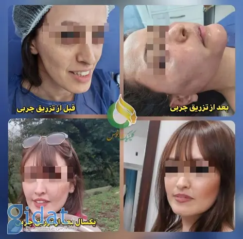 دکتر تزریق چربی در غرب تهران | ویژگی‌ها و نحوه یافتن
