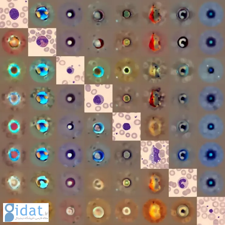 ai-blood-cell-analyzer-cytodiffusion-leukemia-detection-۲-1024x1024.jpeg