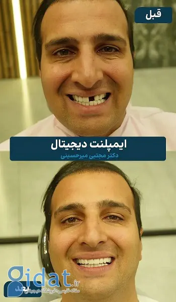 بهترین دندانپزشکی قسطی در تهران + معرفی 10 دندانپزشکی برتر