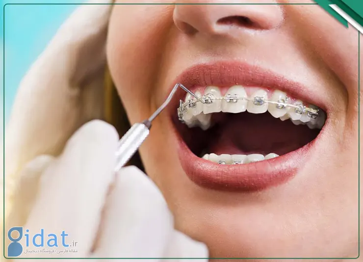 ارتودنسی بزرگسالان