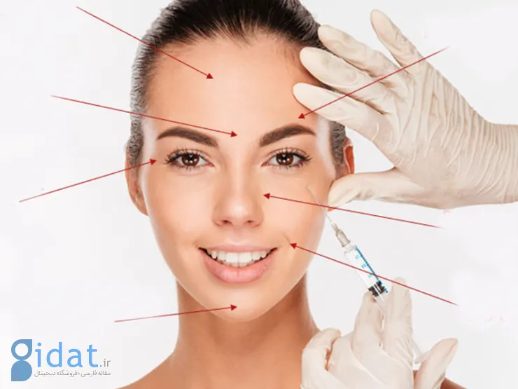 تزریق ژل یا تزریق چربی