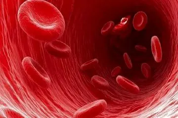 چگونه کم خونی را تشخیص دهیم؟