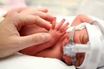 آخرین وضعیت ۵ نوزاد بعد از حریق بیمارستان رشت