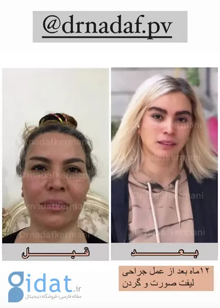 دکتر+نداف+کرمانی+-+فوق+تخصص+جراحی+پلاستیک+و+زیبایی