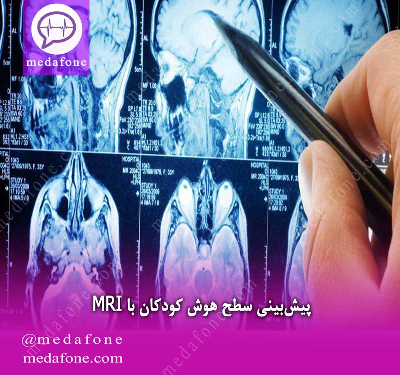 پیش بینی سطح هوش کودکان با MRI