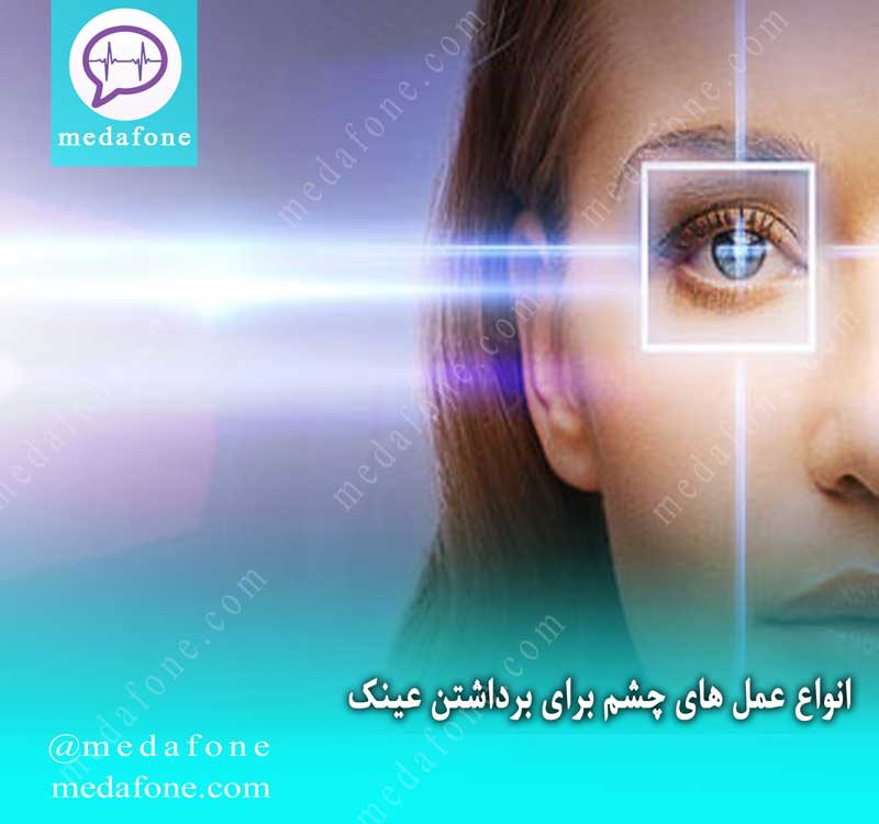 مزایای انواع عمل چشم