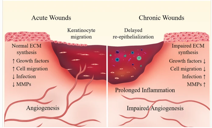 زخم مزمن چیست علل و درمان