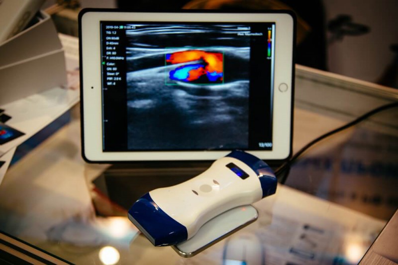 What Is Portable Ultrasound?