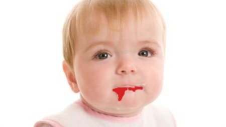 دلایل استفراغ خونی در نوزادان و کودکان