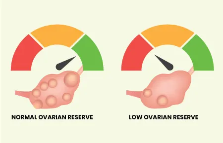 کاهش ذخیره تخمدان, آزمایش ذخیره تخمدان