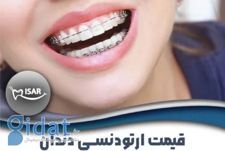 قیمت ارتودنسی دندان با پرداخت اقساطی