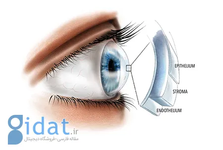 دیستروفی فوکس, درمان دیستروفی فوکس, تشخیص دیستروفی فوکس