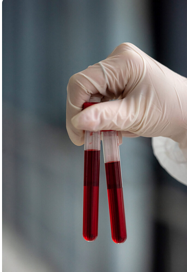 آزمایش خون در منزل: آسایش و سهولت در بررسی سلامتی