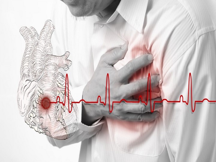 چطور می توان از حمله قلبی اول و حملات بعدی آن جلوگیری کرد؟