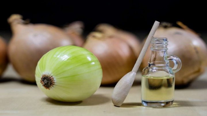 چگونه آب پیاز باعث جلوگیری از ریزش مو می شود؟