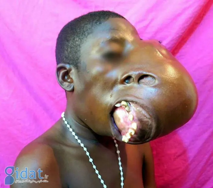 CLpoh8eB09t-png__700