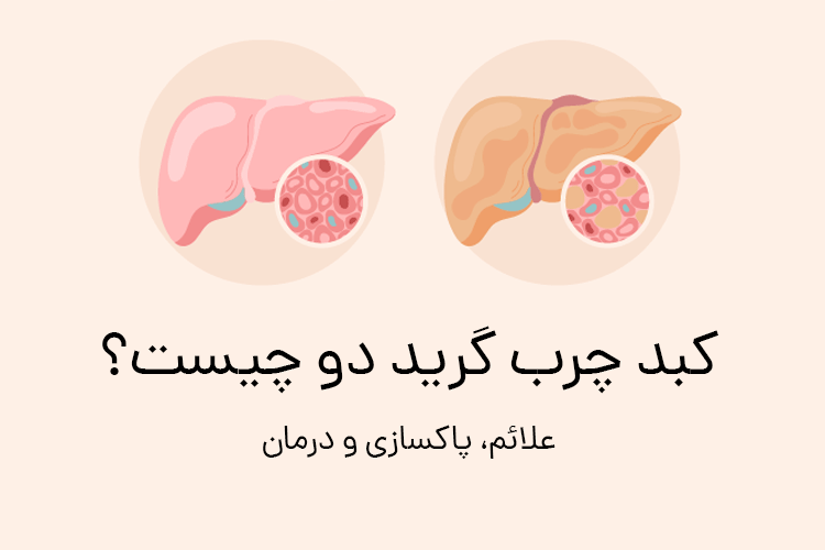 کبد چرب: چگونه این بیماری خاموش را بهبود بخشیم؟