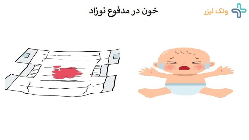 خون در مدفوع نوزاد نشانه چه بیماری است؟