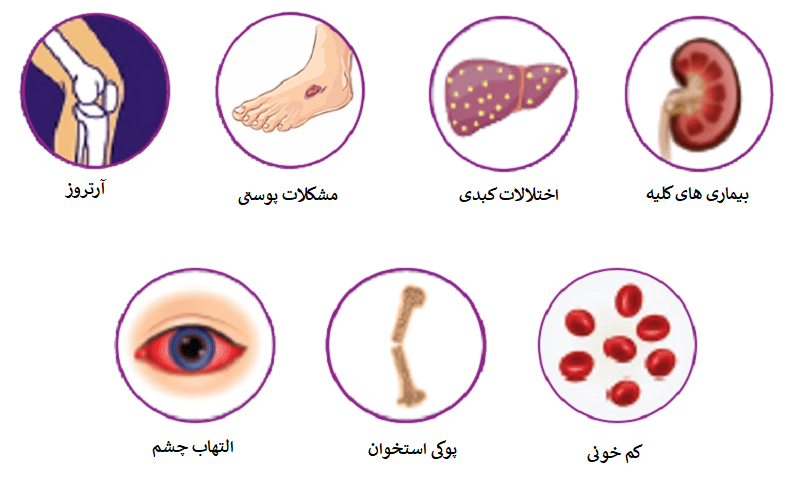 بیماری التهابی روده چه خطراتی دارد؟