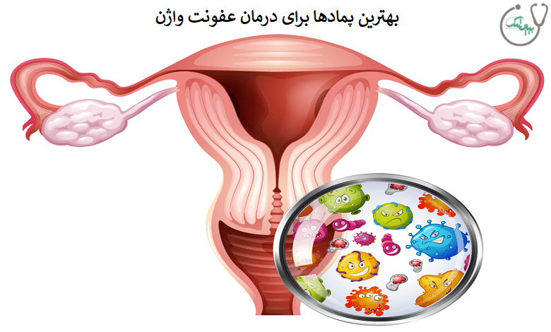 درمان عفونت قارچی واژن با پماد